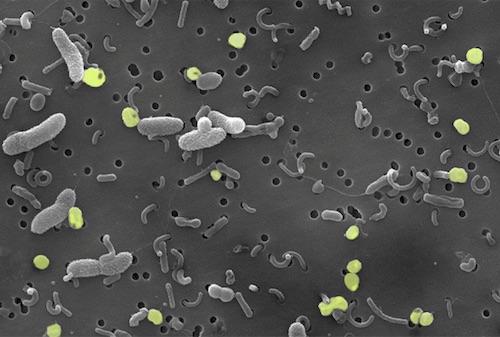 3D model of Electron Micrograph 