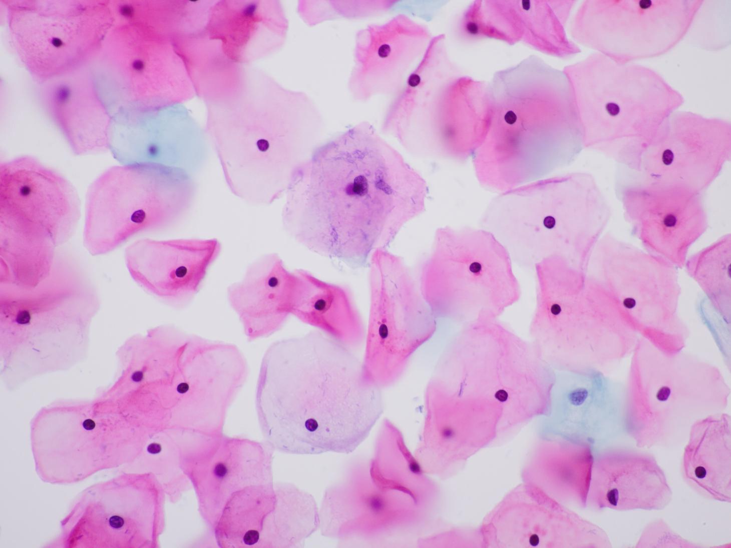 Microscopic view of pink cervix cells as studied by biology majors