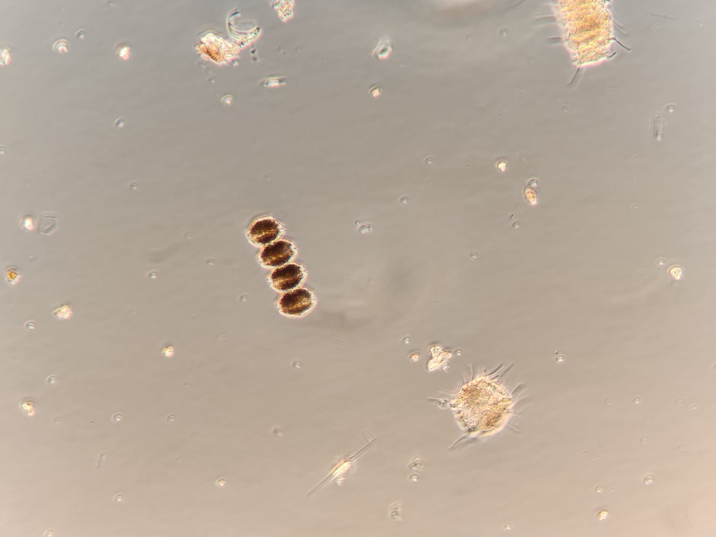 A closeup of four brown cells that are attached in a chain. Under the microscope, this is the Alexandrium catenella 4-cell chain.